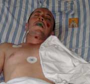 Ucraineanul accidentat pe trecerea de pietoni de la Bazar a decedat după 11 zile de agonie