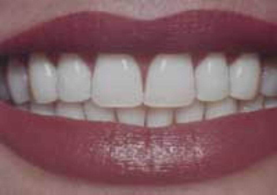 Alimentația și sănătatea dinților tăi Alimentația și sănătatea dinților tăi