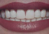 Alimentația și sănătatea dinților tăi