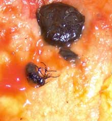 O cîmpulungeancă a cumpărat o gustare ambalată cu o muscă-surpriză