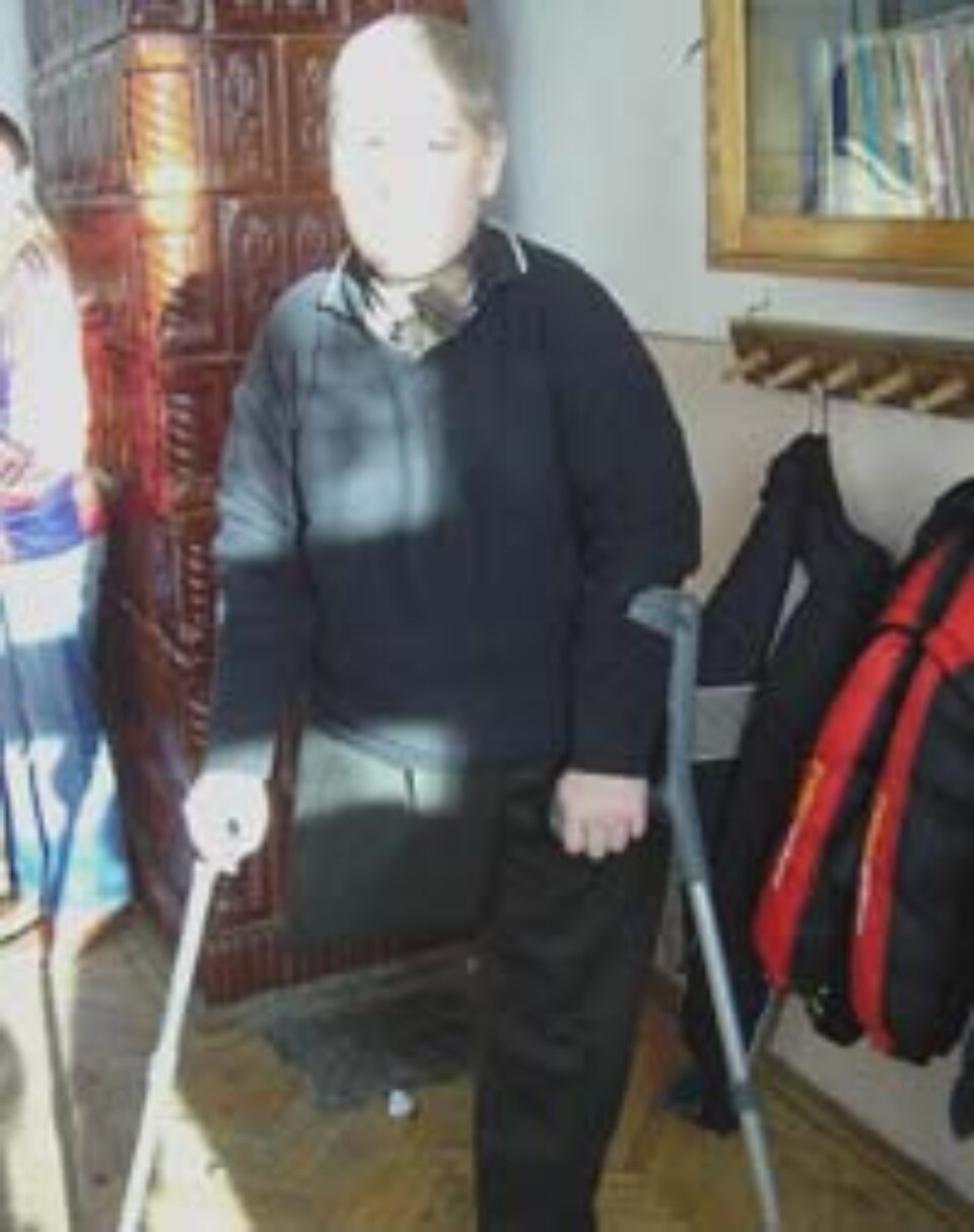 Scrisoare pentru Moș Crăciun de la un copil cu un picior amputat