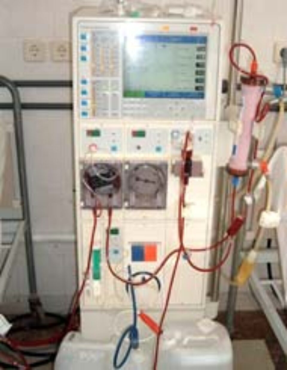 Aproximativ 200 de suceveni sunt ținuți în viață cu ajutorul dializei