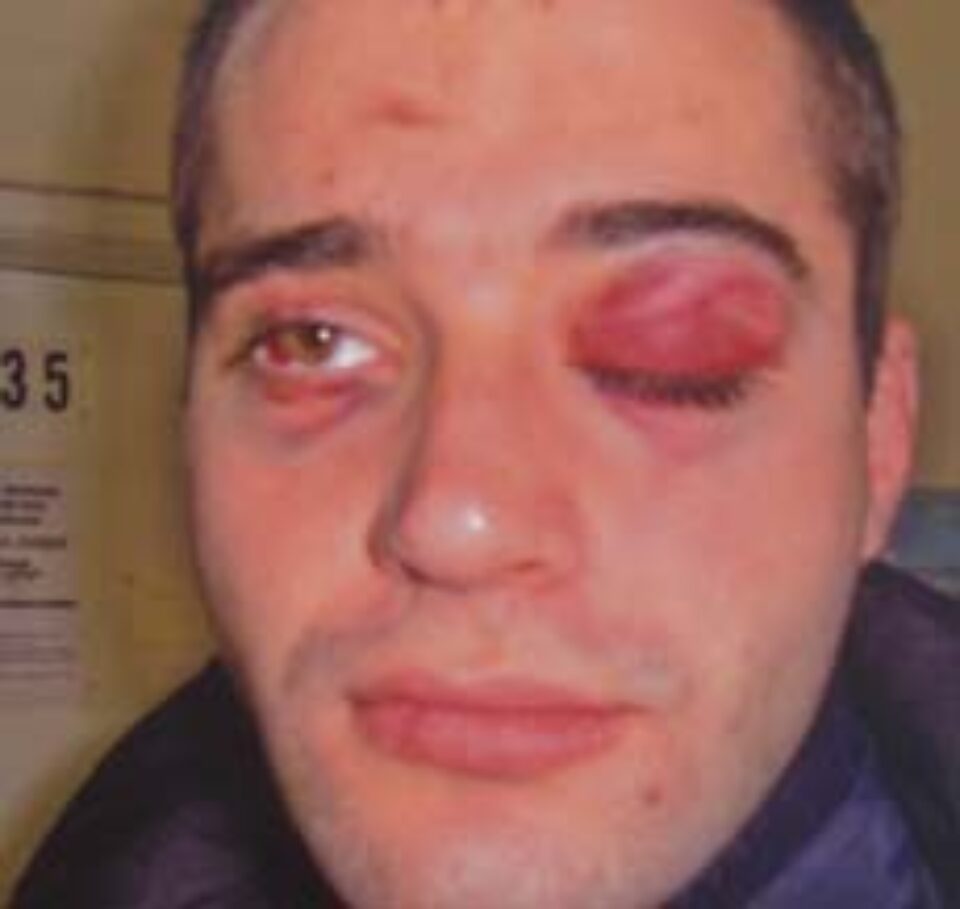 Stâlcit în bătaie de fiul lui Severin Tcaciuc