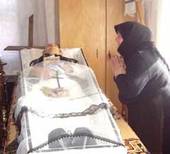 A murit după o banală operație la picior