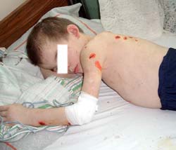 Băiețelul maltratat de propria mamă va fi luat din familie