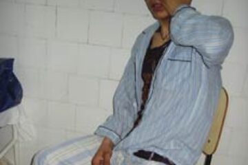 Minor împușcat de polițiști