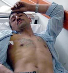 Recidivistul împușcat la Dornești va fi transferat la un spital din rețeaua penitenciară