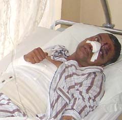 Pieton făcut minge de ping-pong între două autoturisme