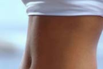 Cum atenuăm vergeturile?