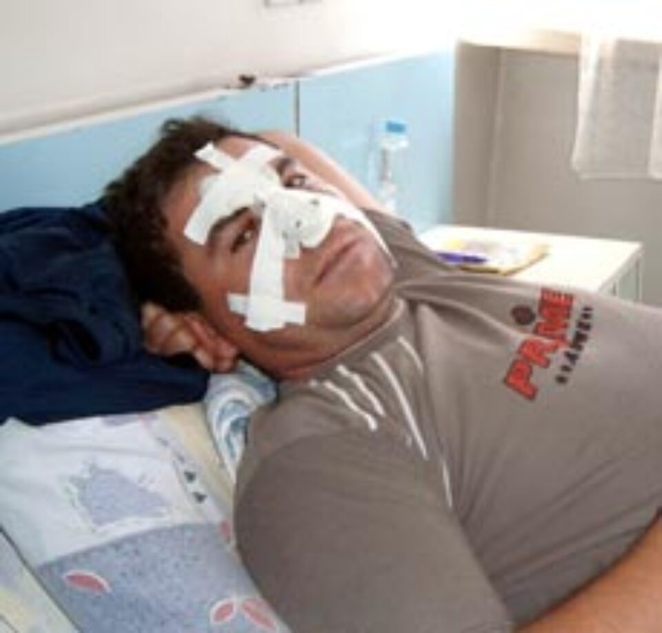 Cornel Hrebenciuc a fost internat în Secţia ORL a Spitalului Judeţean Suceava, cu traumatism cranio – facial, plăgi la nivelul feţei şi fractură de piramidă nazală Cornel Hrebenciuc a fost internat în Secţia ORL a Spitalului Judeţean Suceava, cu traumatism cranio – facial, plăgi la nivelul feţei şi fractură de piramidă nazală