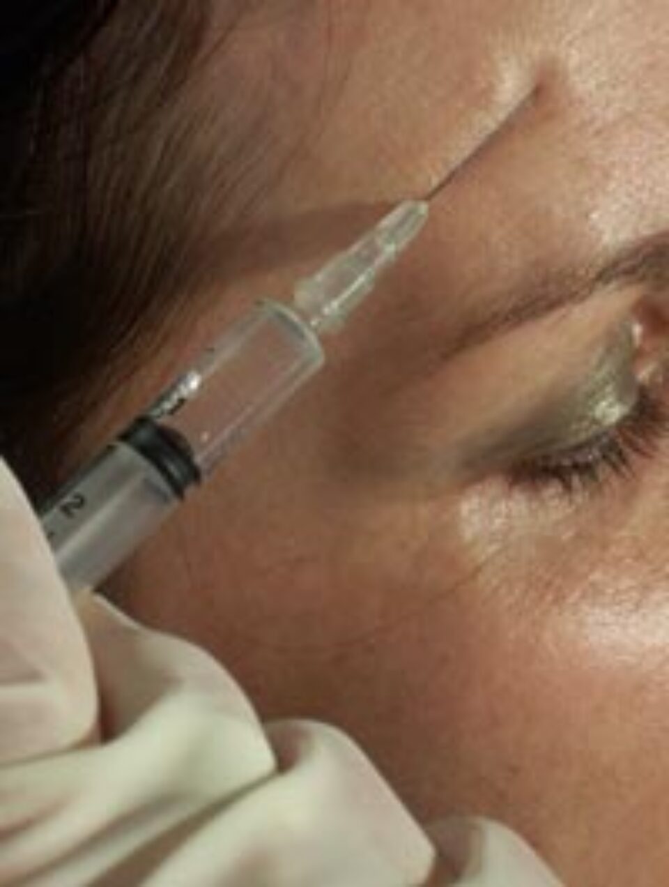 Tratamentele cu Botox pot crea dependență Tratamentele cu Botox pot crea dependență