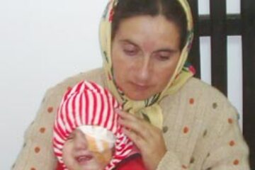 Ajutor pentru fetița care necesită implantare de cristalin artificial