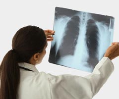 Radiologii, obligați să informeze în scris pacienții despre doza de iradiere primită