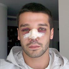 Chivu, incert pentru meciul cu Olanda