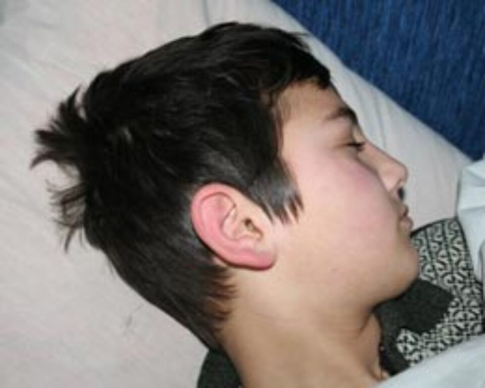 Copilul lovit, care trebuie să suporte „o făcătură