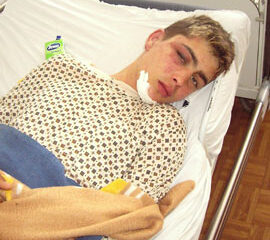 Tânăr snopit în bătaie de polițiștii din Dumbrăveni