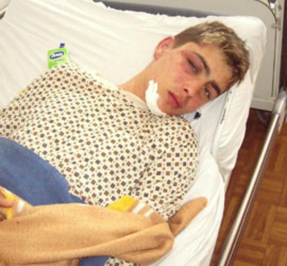 Tânăr snopit în bătaie de polițiștii din Dumbrăveni Tânăr snopit în bătaie de polițiștii din Dumbrăveni