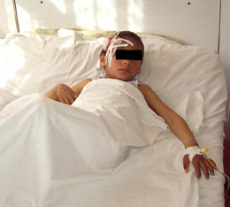 Copil lovit cu toporul de unchiul său