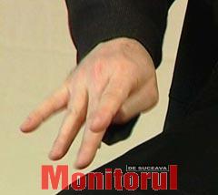 Un medicament împotriva hipertensiunii arteriale ar putea stopa evoluția maladiei Parkinson