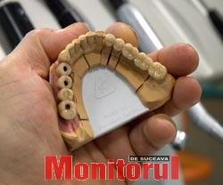 Implantul dentar, înlocuitor perfect pentru dinții distruși