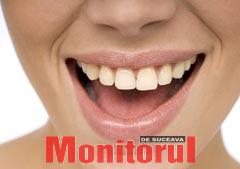 Trusele de albire a dinților, periculoase pentru gingii