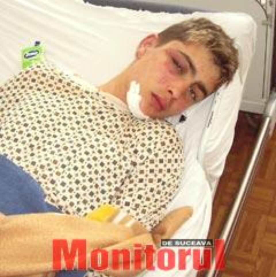 Bogdan Faraon: „Loveau cu bastoanele şi cu picioare pe unde apucau. Cred că m-au bătut vreo două ore...” Bogdan Faraon: „Loveau cu bastoanele şi cu picioare pe unde apucau. Cred că m-au bătut vreo două ore...”