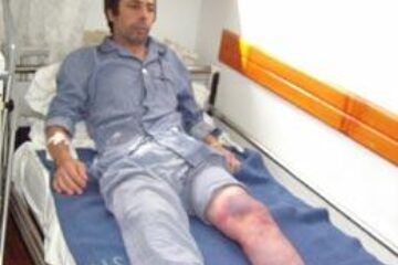 Lăsat handicapat pe viață, din cauza incompetenței unor medici