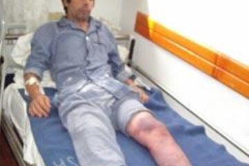 Colegiul Medicilor a demarat o anchetă în cazul pacientului rămas fără un picior