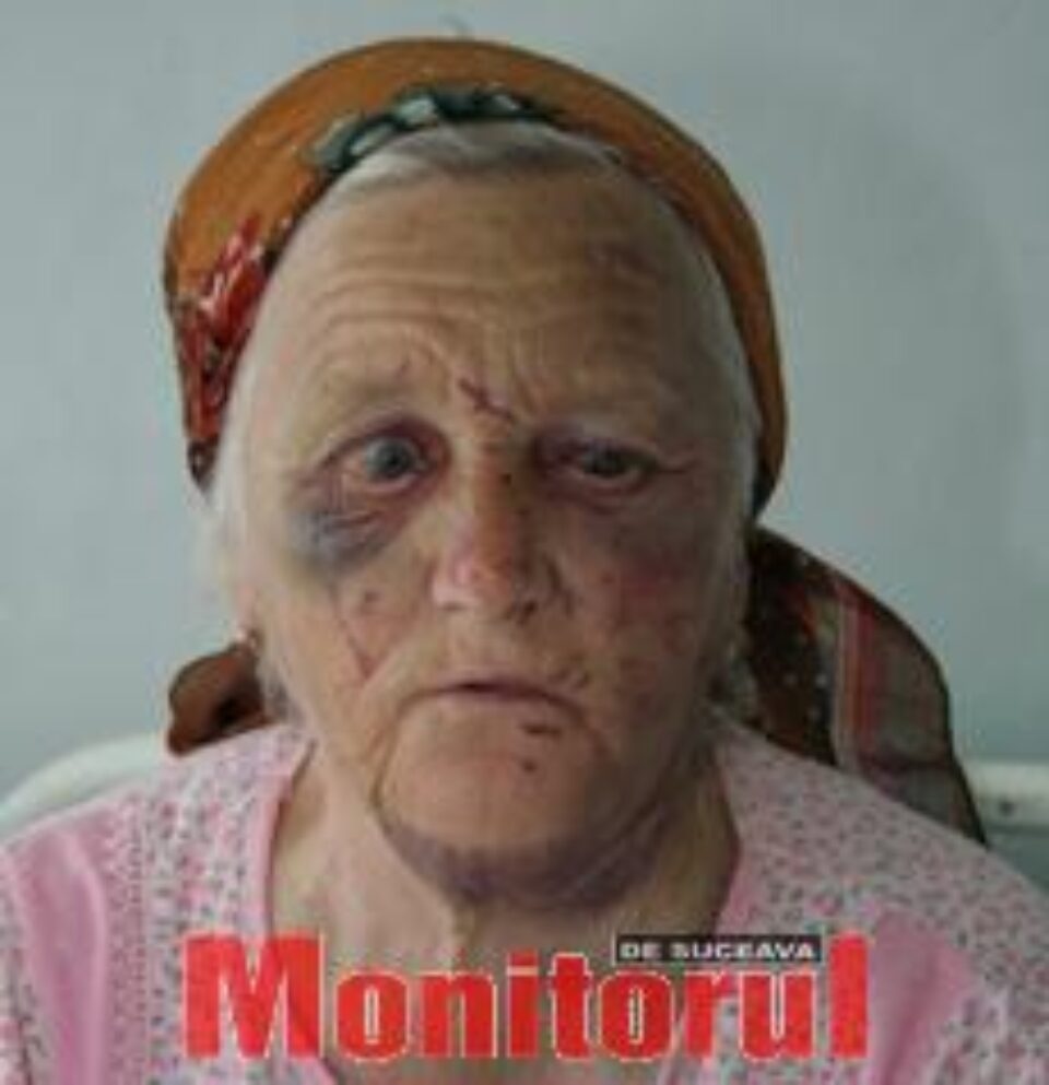 Bătrână de 80 de ani, atacată și bătută crunt în casă
