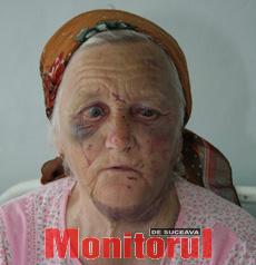 Bătrână de 80 de ani, atacată și bătută crunt în casă