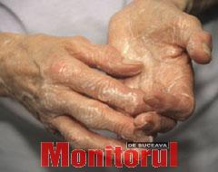 Remedii pentru tratarea suferinzilor de reumatism