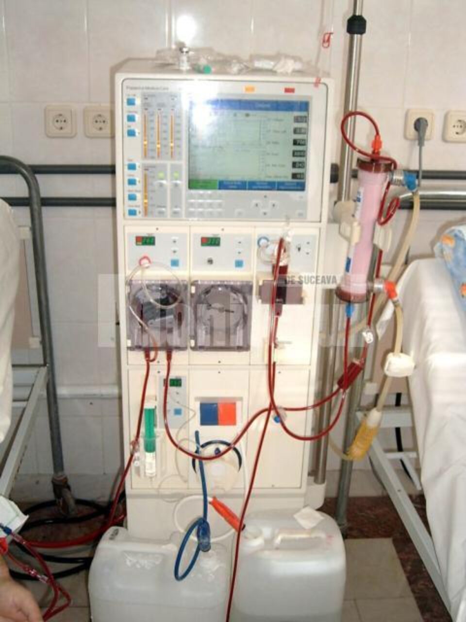 La Centrul de Dializă din cadrul Spitalului Județean Suceava sunt 25 de aparate