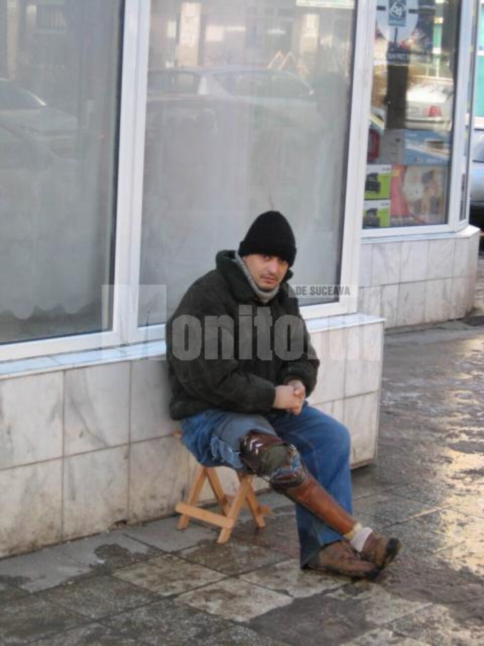 Social: Mai are nevoie de 500 de lei pentru o proteză la picior