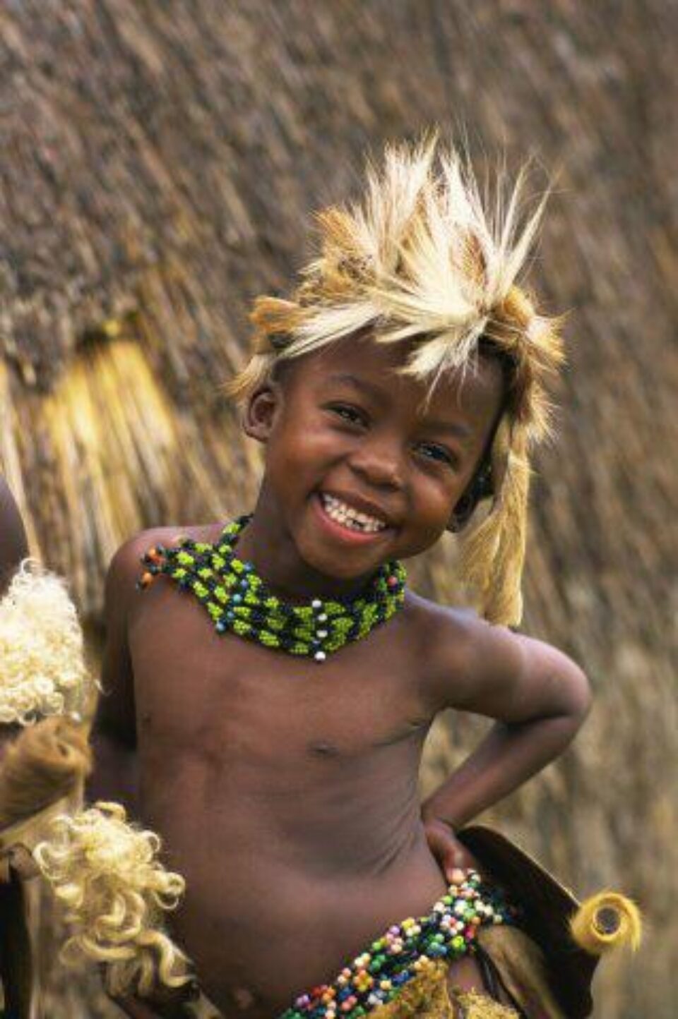 Africanii au mai puține riscuri de boli genetice