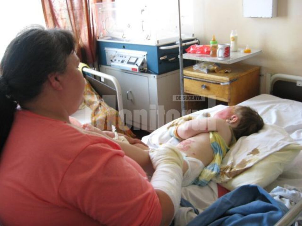 Fetița a suferit arsuri grave după ce a fost cuprinsă de flăcările izbucnite la un aragaz defect Fetița a suferit arsuri grave după ce a fost cuprinsă de flăcările izbucnite la un aragaz defect
