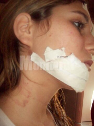 Povestea de dragoste a Florentinei s-a sfârșit la spital.