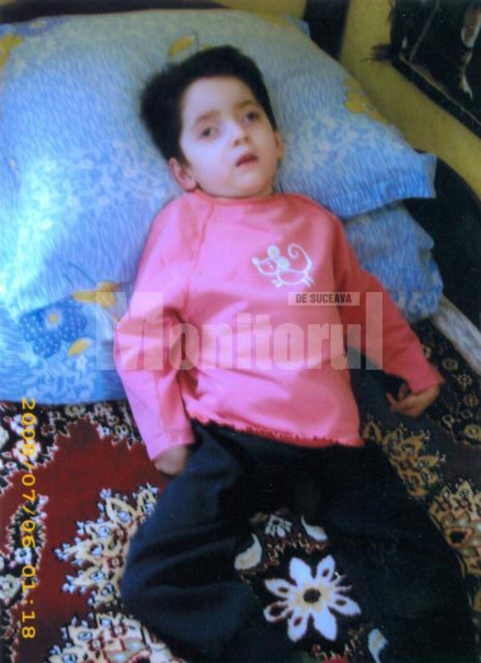 Andreea Pintescu are nevoie de un transplant de celule stem în China