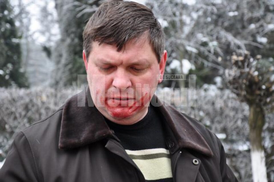 Director Boliacu:” Un individ a sărit la gâtul meu, m-a sugrumat și m-a lovit în mai multe rânduri în față”