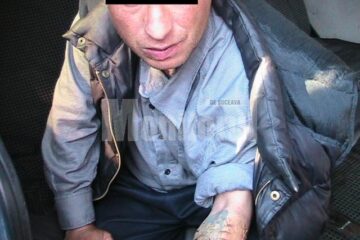 Tânărul care s-a automutilat pentru a impresiona trecătorii