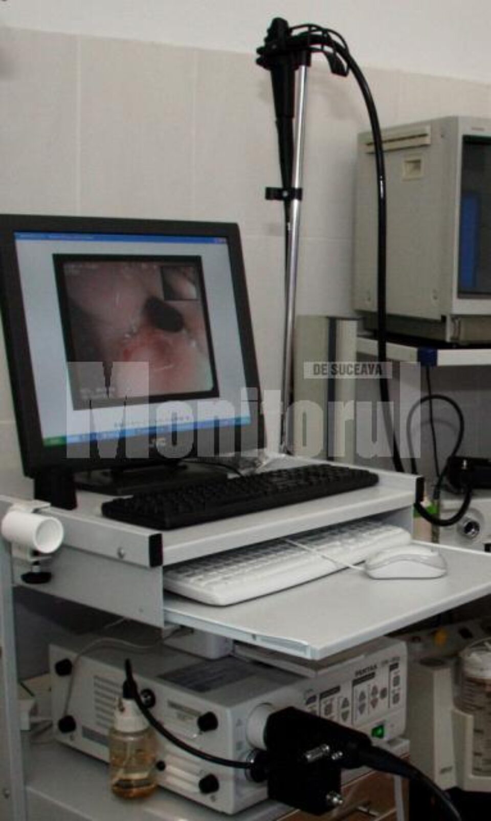 Dotare: Aparatură de diagnostic de ultimă generație, la Spitalul de Urgență