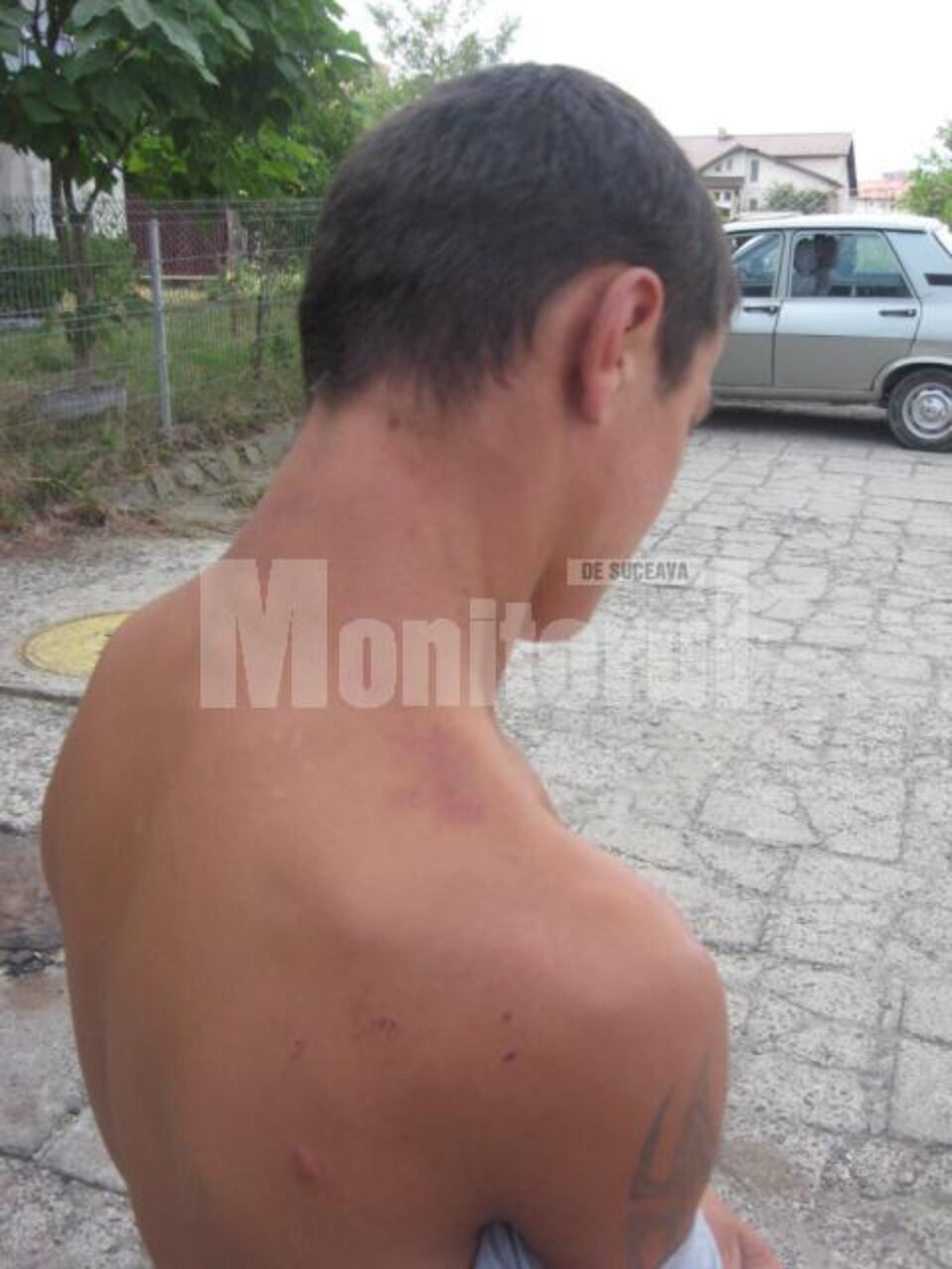 Băiatul de 14 ani a ajuns la Spitalul Județean Suceava