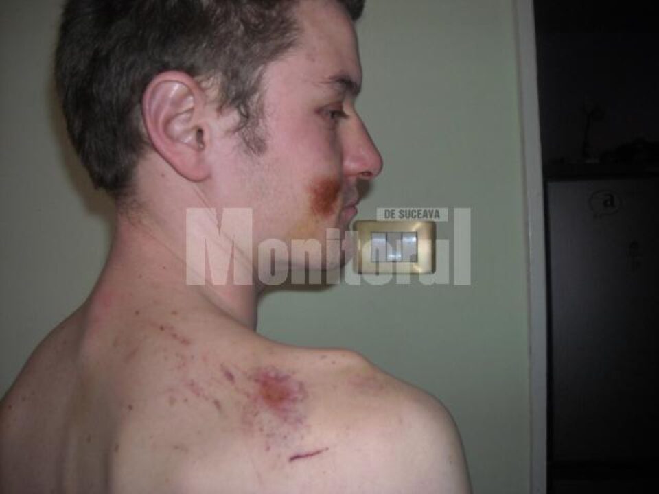 Reclamație: Doi polițiști, acuzați că au bătut crunt un tânăr care făcea scandal
