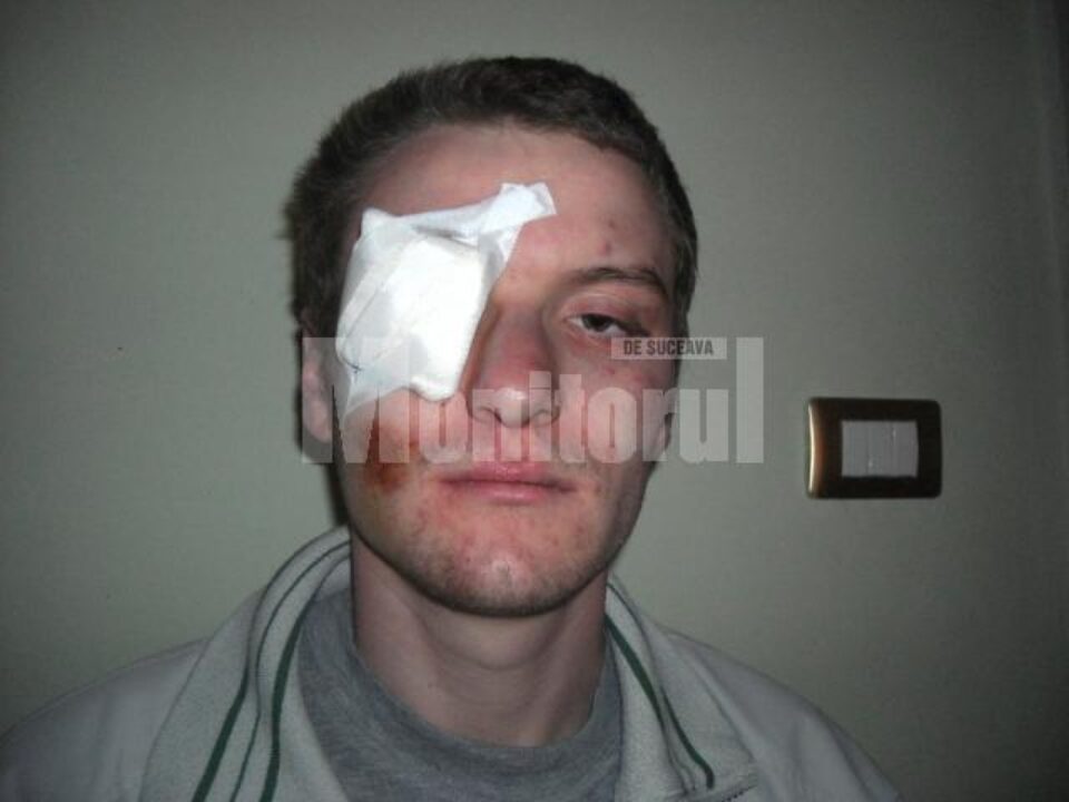 Radu Iacob, tânărul care reclamă că a fost bătut crunt de polițiști