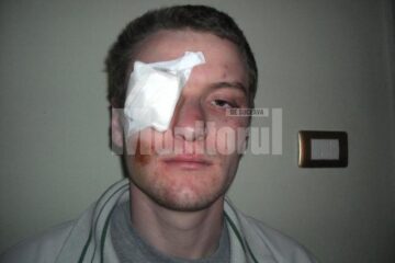Radu Iacob, tânărul care reclamă că a fost bătut crunt de polițiști