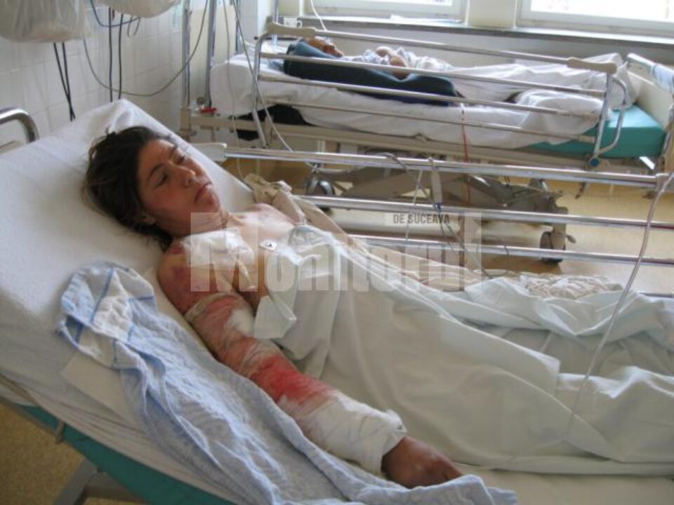 Maria Neamtu, ultima victima a cainilor ucigasi, a fost la un pas de moarte