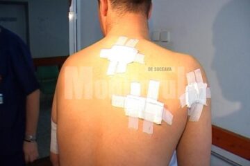 Marian Tabac: Mi-a dat cineva cu un cuțit în spate