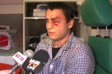 Medicii nu au mai putut să-i salveze ochiul lui Ioan Cezar Turcu