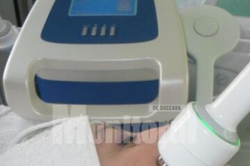 Cu aparatul Apollo, ultima inovație în domeniu, sucevencele pot întineri cu cel puțin cinci ani
