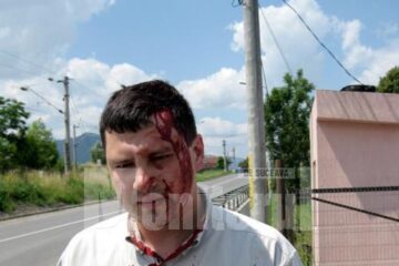Inspectorul Viorel Ciuc, bătut de un consilier local din Câmpulung Moldovenesc