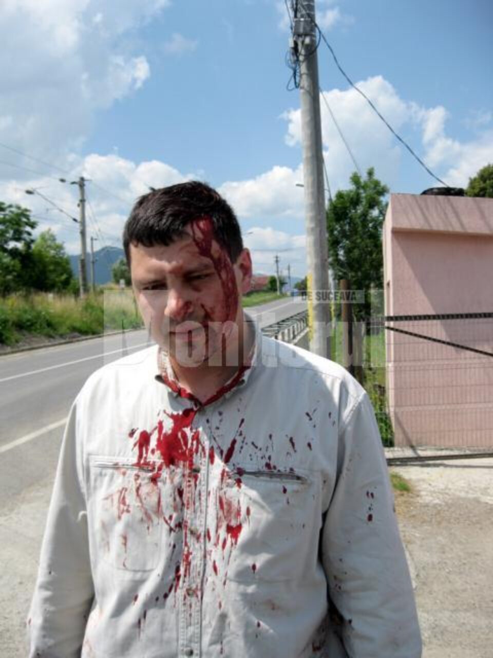 Inspectorul Viorel Ciuc, bătut de un consilier local din Câmpulung Moldovenesc